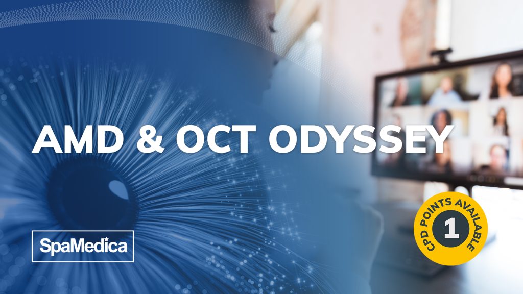 AMD & OCT Odyssey – 1 Point