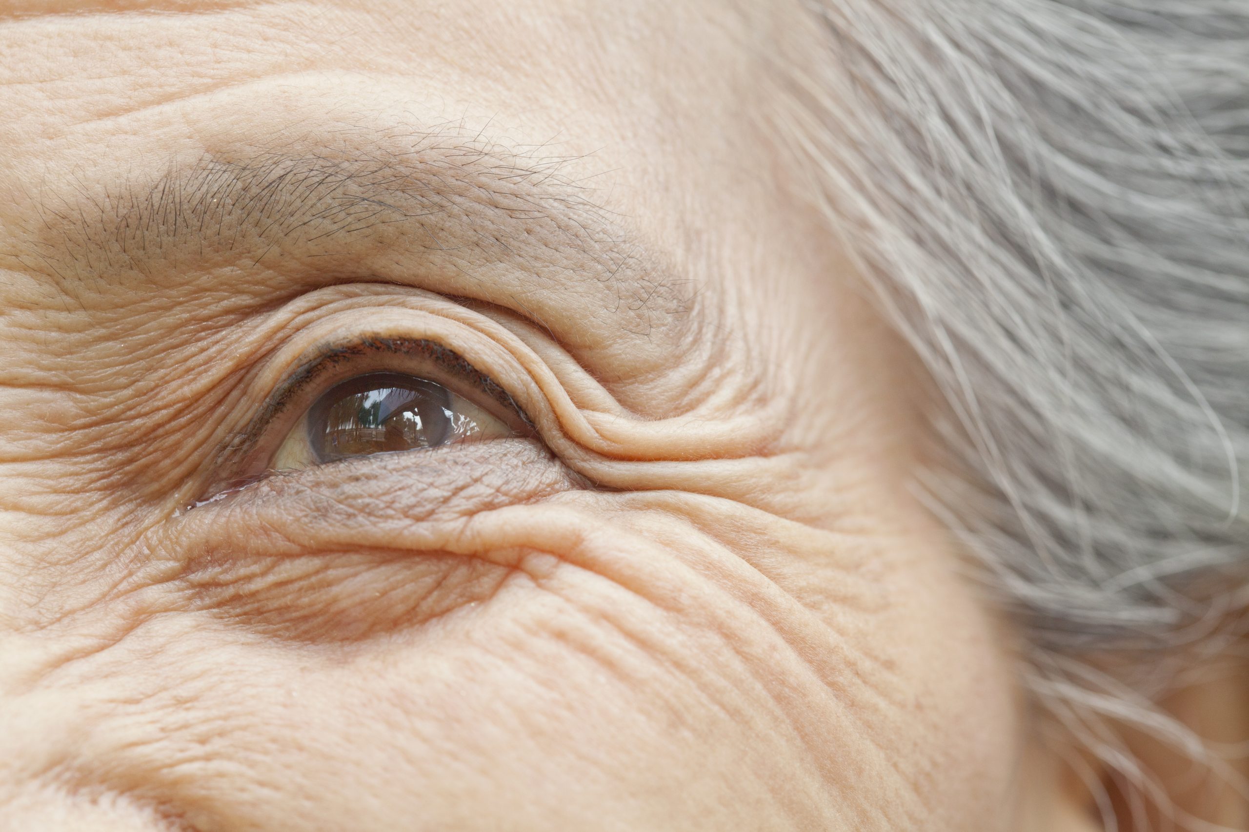 Close up picture of an elderly woman's eye